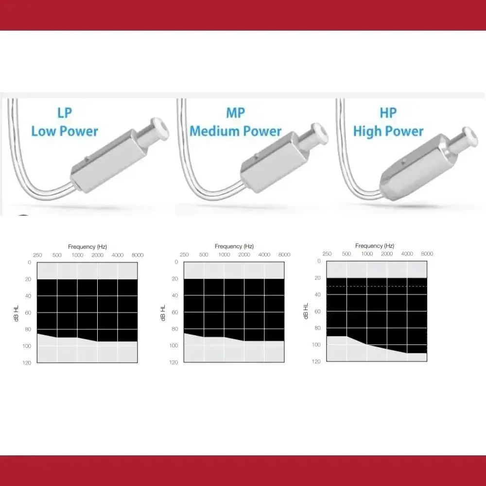 Фото Резионный приемник SureFit2c |   Опции LP/MP/HP для слуховых аппаратов Linx3D/LiNX2/Quattro/Enya №4