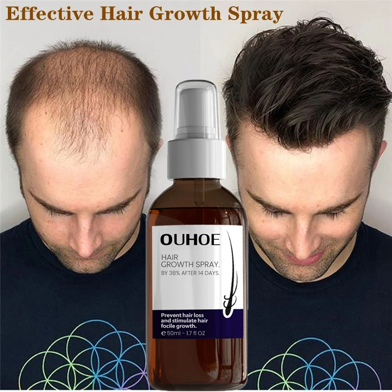

Hair Growth Spray Fast Growing Hair Essential Oil Promote Hair Grow Thicker Anti Hair Loss Scalp Treatment Nourish Hair Products