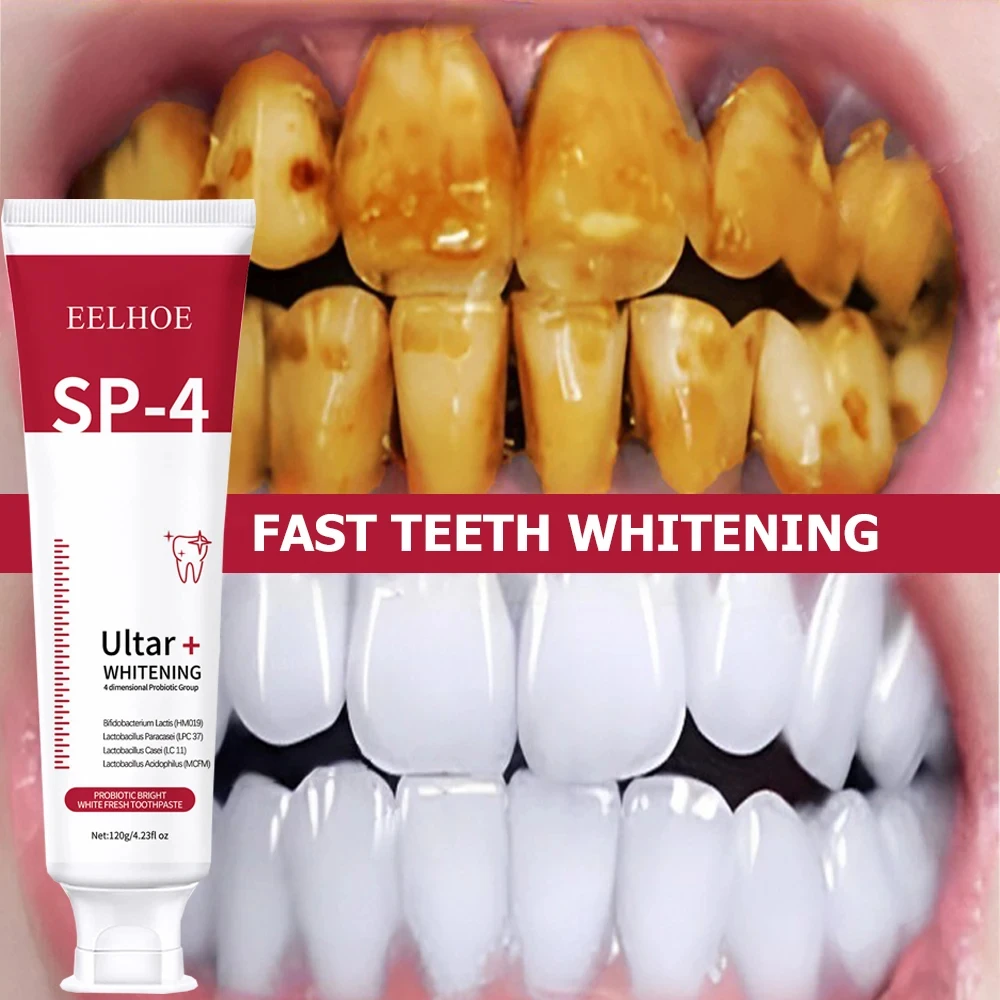 

Probiotic Caries Toothpaste SP 4 Whitening Tooth Decay Repair Paste Teeth Cleaner Plaque Remover Fresh Breath Dental Care 120g