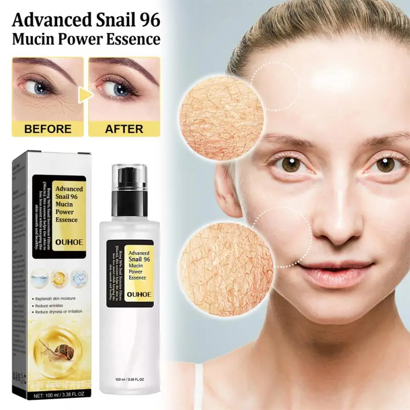 

Snail Whiten Face Serum Improve Skin Dullness Mild Hydrating Essence Firming Skin Shrink Pores Rejuvenating Essence Cosmetics