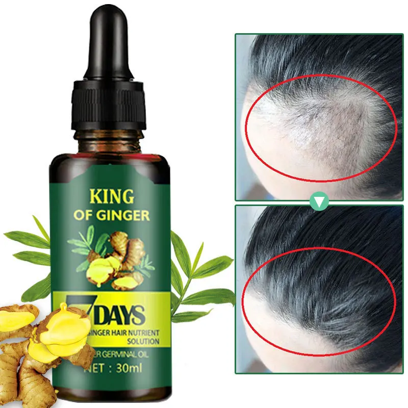 

Thick Hair Nourishing Ginger King Nutrient Solution Refreshing and Moisturizing Scalp Follicle Strong Hair Care Essential Oil