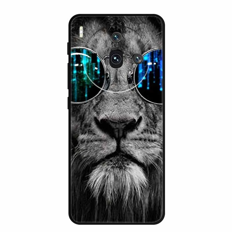 Чехол для телефона ZTE nubia Z50S Pro Z50SPro черный силиконовый мягкий чехол на заднюю