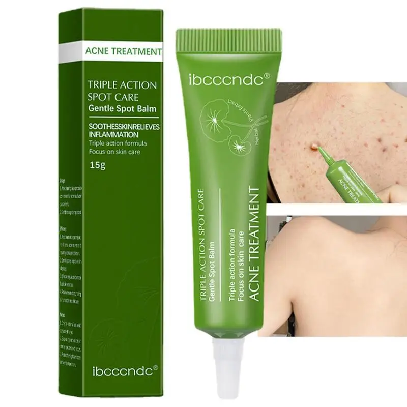 

Acnes Remover Gel Herbal And Organic Scar Remover Scar Cream For Blackhead Repairing Acnes Marks And Blemishing