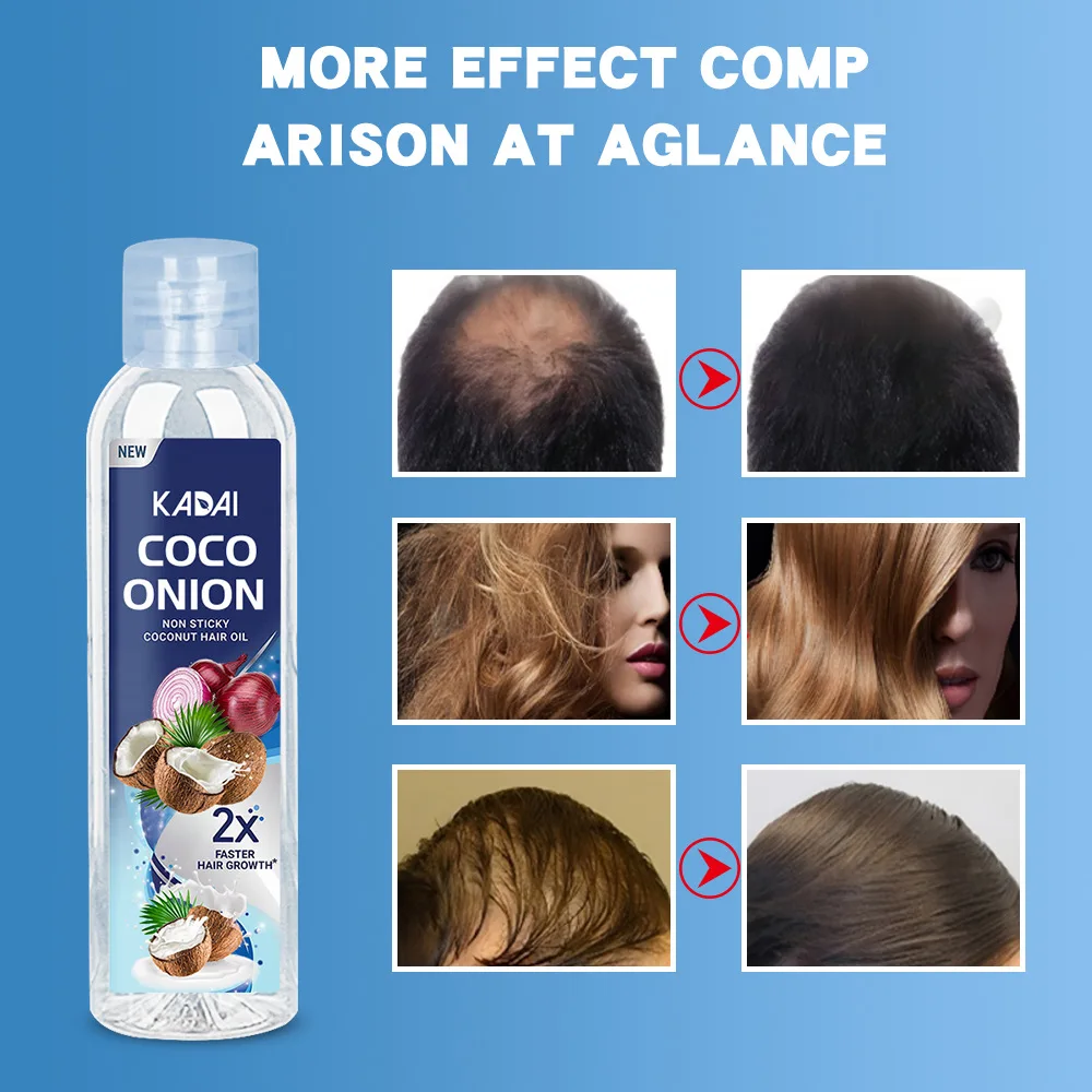 

100ml Coconut Hair Care Essential Oil Hair Enhancement Hair Loss Prevention Hair Tightness Repair Coco Onion Hair Oil Hair Care