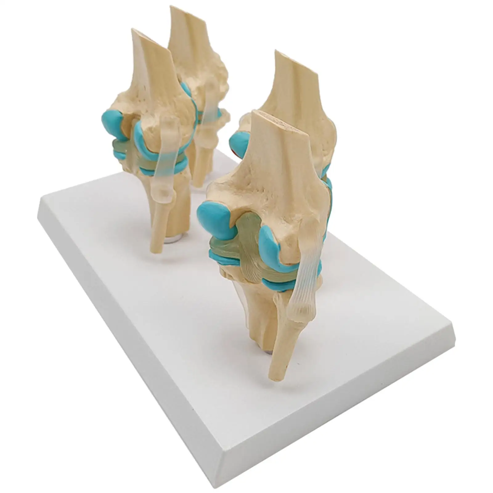 

Human Knee Model Degenerative Knee Joint Disease Model for Teaching Explanation Teaching
