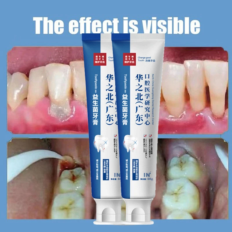 

2023 New Quick Repair of Cavities Caries Removal of Plaque Stains Decay Whitening Yellowing Repair Teeth Teeth Whitening
