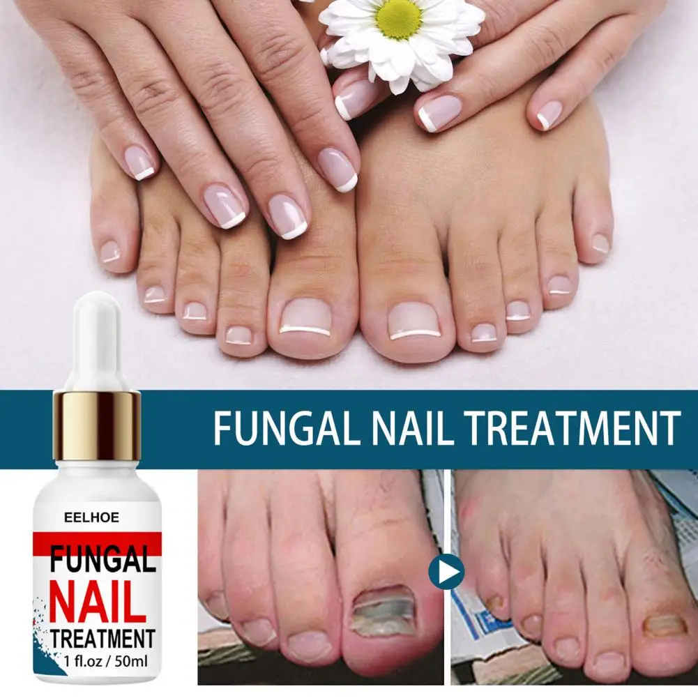 

Nail Treatment Oil Excellent Gentle No Stimulation Nail Supplies Nail Nutrition-Liquid Nail Strengthener Oil