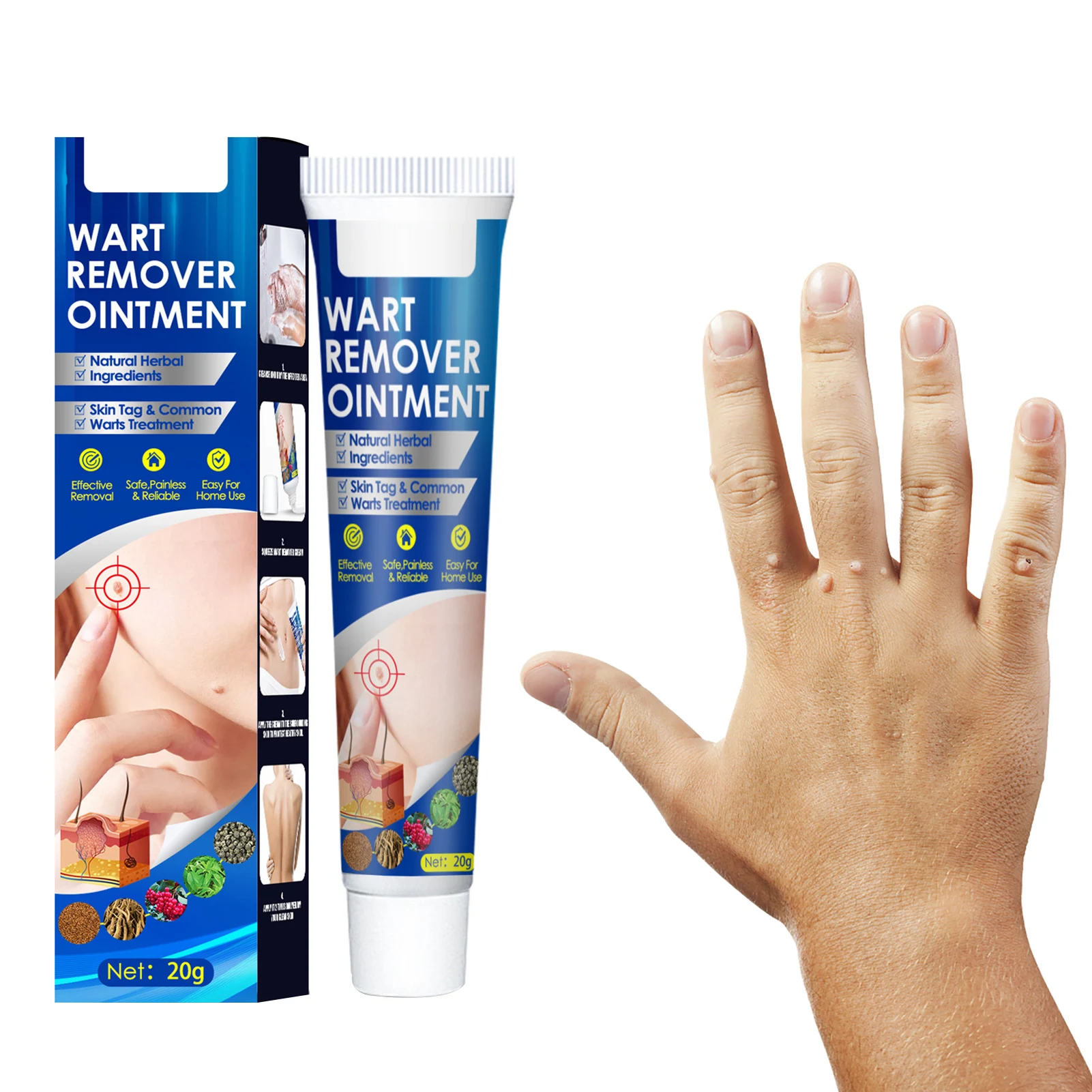

Wart Remover Cream Wart Remover Ointment Wart Cream With Natural Herbal Ingredients For Hands Feet Face Neck Armpits