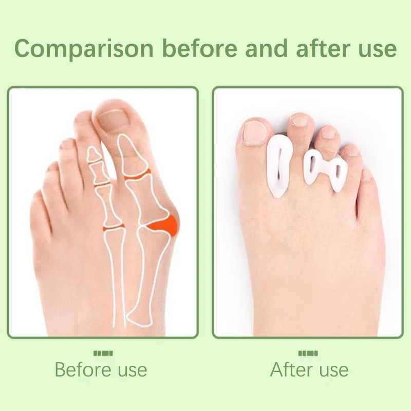 Рисунок 3 - 1 пара, разделители для пальцев ног