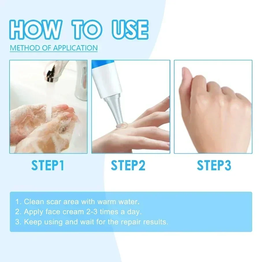 Новинка крем для удаления шрамов восстанавливающий растяжек жирных ухода за