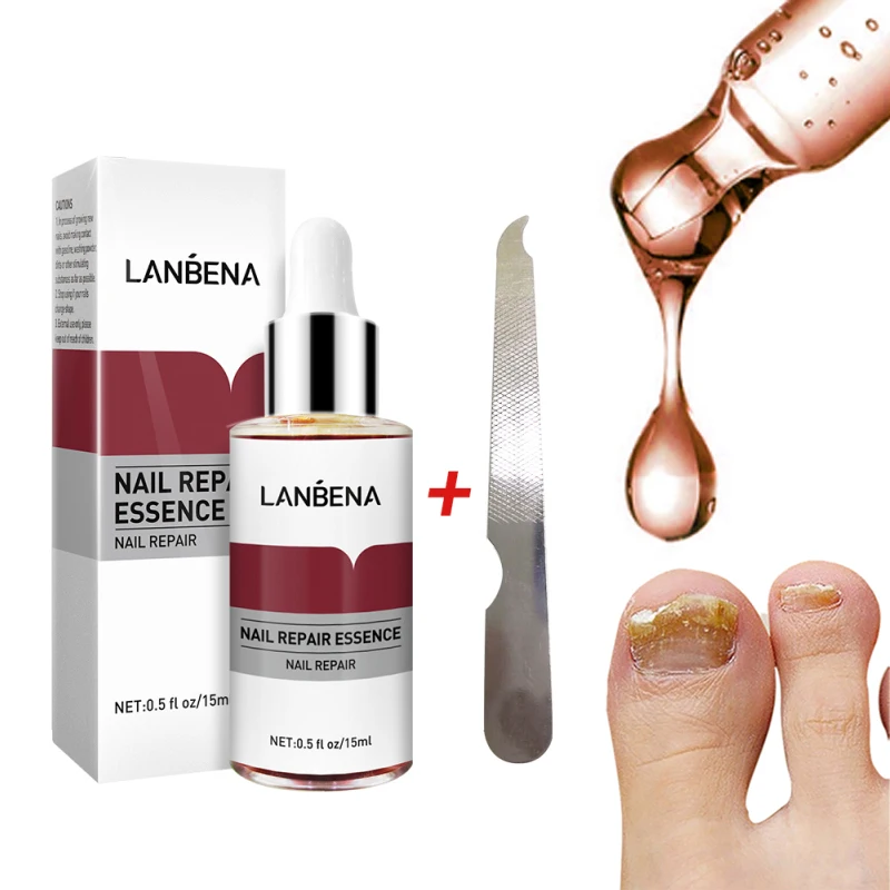 

LANBENA Nail Fungus Treatment Essence Serum Care Hand And Foot Care Removal Repair Gel Anti-infective Paronychia Onychomycosis