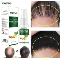 ginger hair growth spray fast growth serum repair dry frizzy scalp treatment essential oil anti hair loss nourishing beauty care