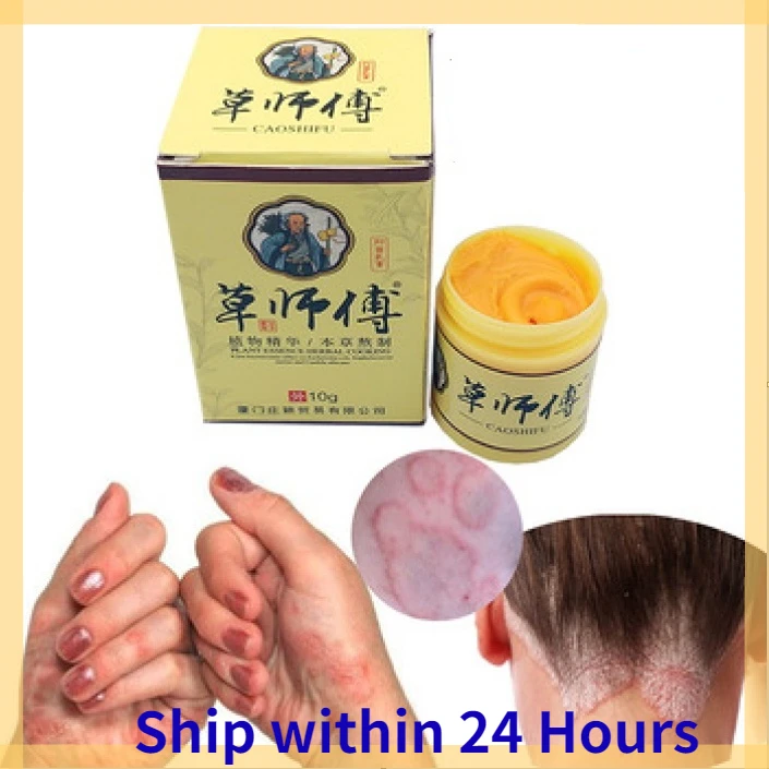 

10g Dermatitis Eczematoin Eczema Psoriasis anti itch herbal Cream Ointment Skin Cream CaoShiFu China brand