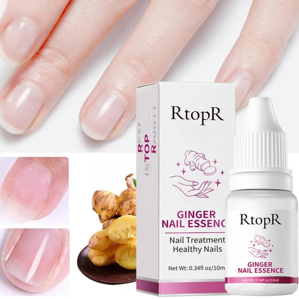 

Эссенция для лечения Ногтей имбиря, удаление поврежденных слоев ногтей, Уход за ногтями, восстановление инфекции ногтей, стимулирование гр...