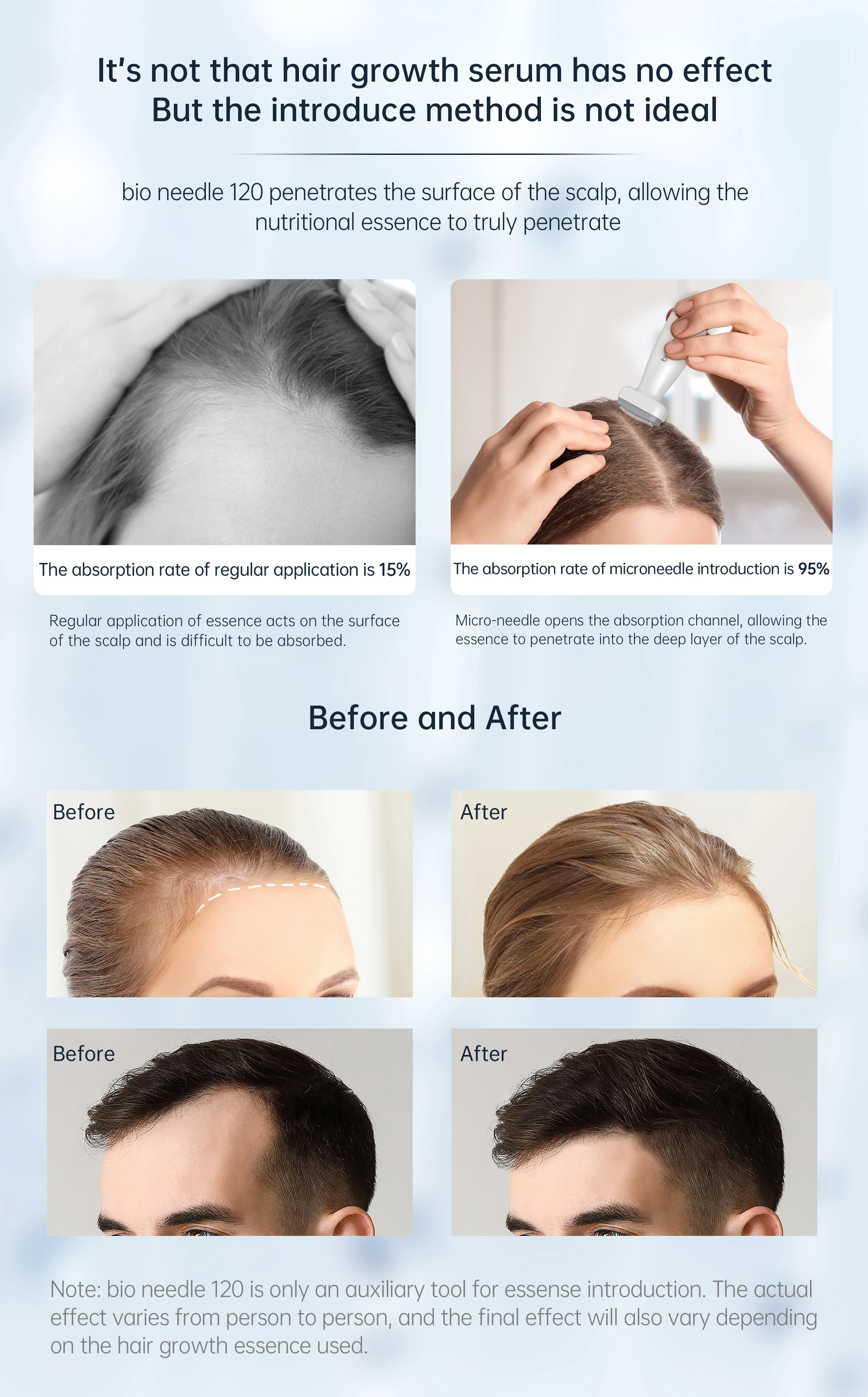 Hello Face Derma Stamp Инструмент Для Ухода За Кожей С Микроиглами И Регулируемой Биоиглой