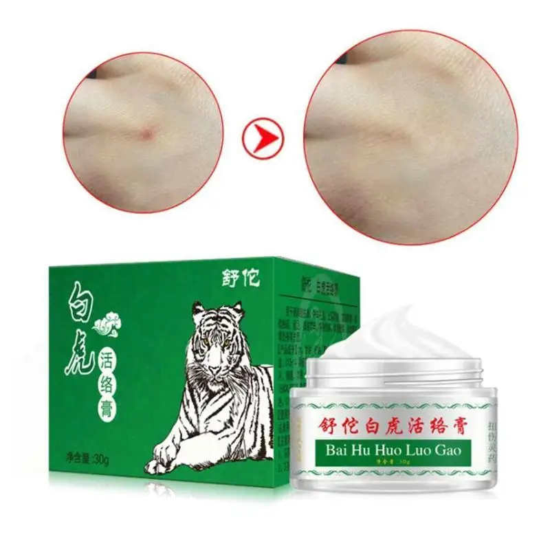 

Белый тигровый бальзам, охлаждающее масло, мятный крем, облегчающее освежающее средство для тела, летом, 1 шт., 30 г