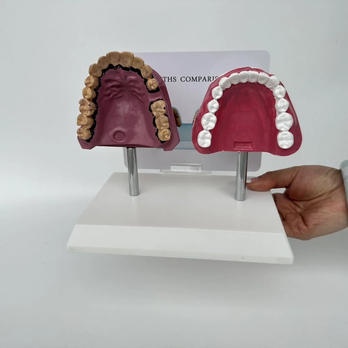 Модель сравнения курительных зубов и нормальных зубов. обучения уходу за