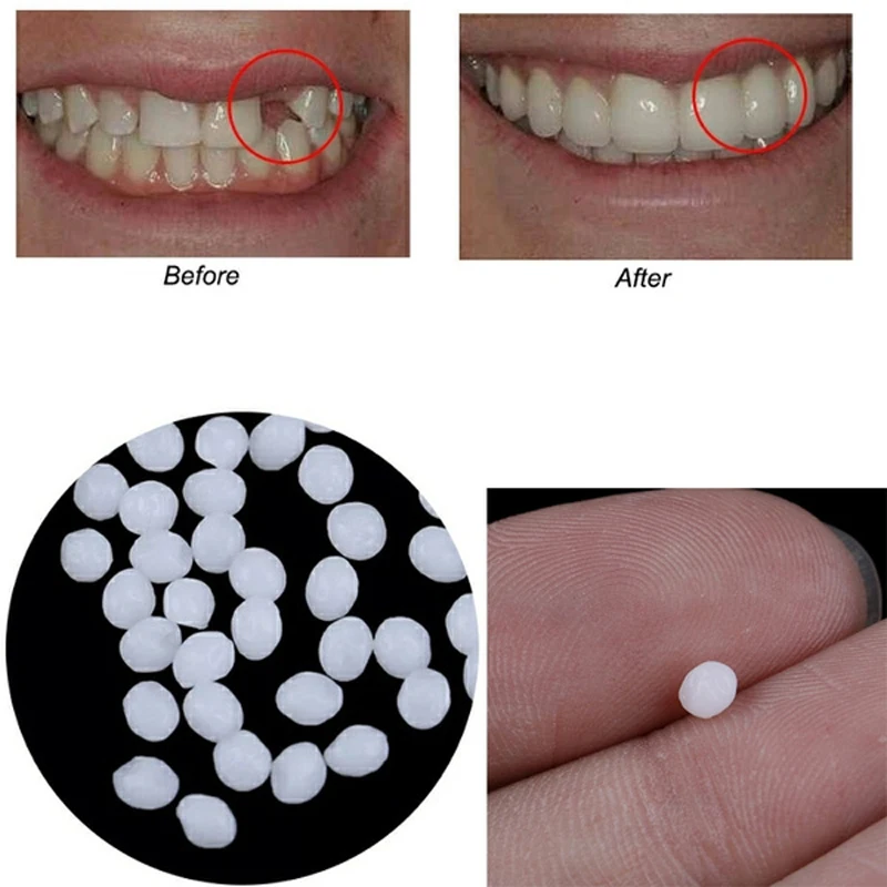 

50g Resin False Teeth Solid Glue Temporary Repair Kit and Gap Denture Adhesive Dentist