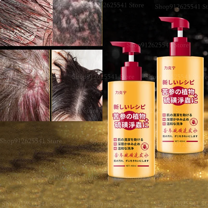 

Шампунь против перхоти и зуда, 400 мл