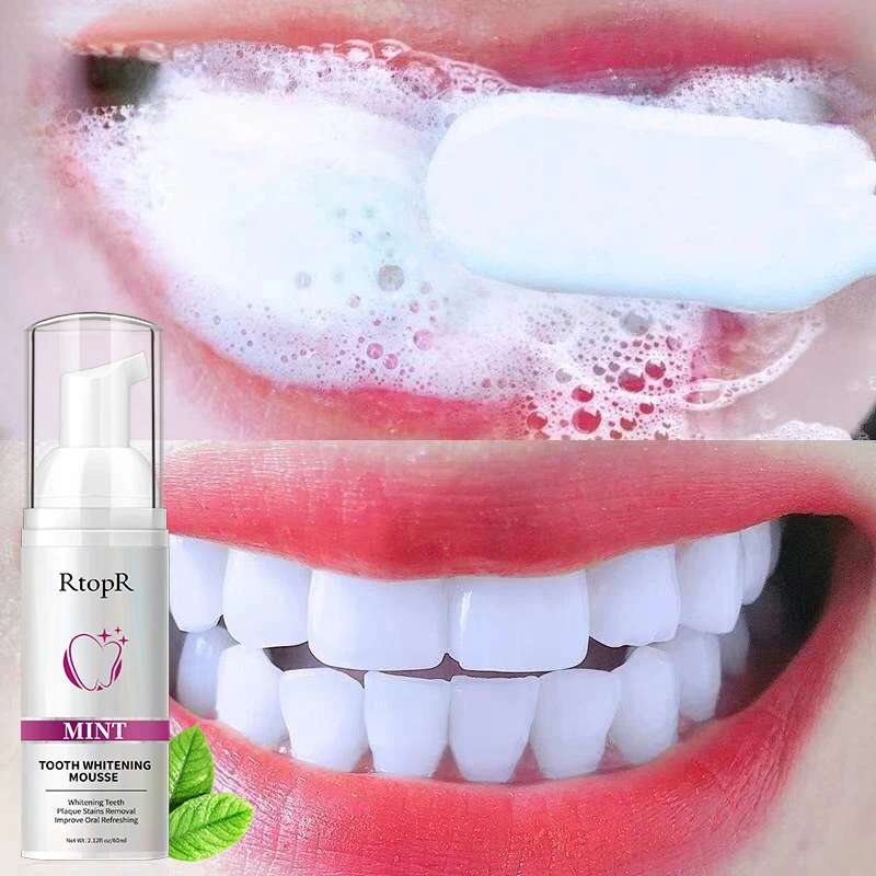 

Teeth Cleansing Whitening Mousse Removes Stains Teeth Whitening Oral Hygiene Mousse Toothpaste Whitening and Staining 60ml