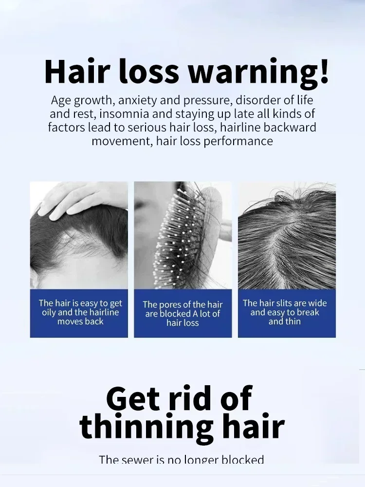 Эфирное масло для роста волос укрепления лечение сухой Mila органическое эфирное