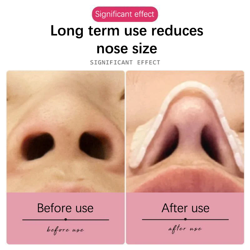 Низкотемпературная термопластичная пластина для носовой шины