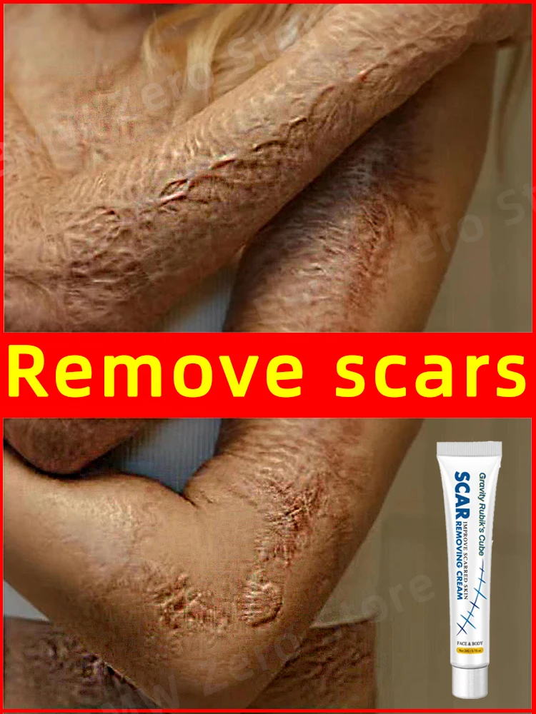 

Scar Removal Ointment Remove Scars Repair Cream