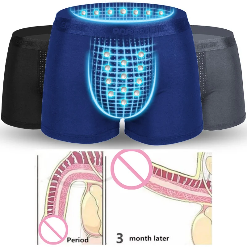 Мужские боксеры английская технология магнитной терапии сексуальное нижнее