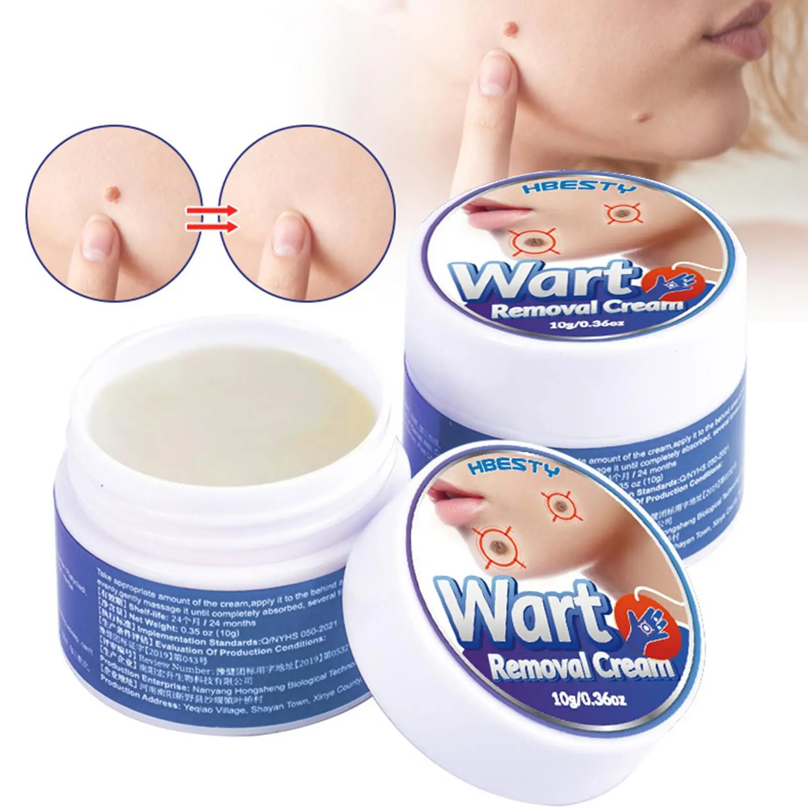 

10G Wart Remover Safe Painless Skin Tags Removal Ointment Fast Acting Remover Cream for Warts Moles Corn for All Skins