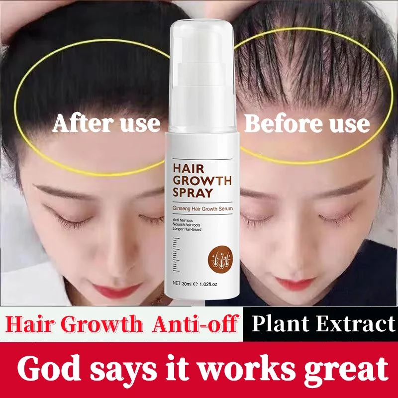

Спрей для роста волос эссенция для роста волос спрей эфирное масло против выпадения волос лечение для мужчин и женщин