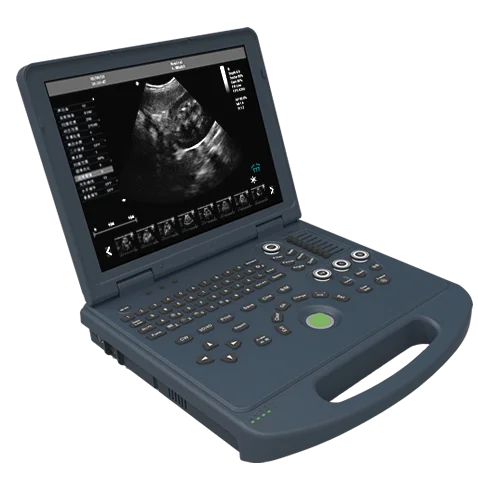 

Diagnostic trolley 3d 4d color doppler ultrasound machine scanner system price for pregnancy with probe