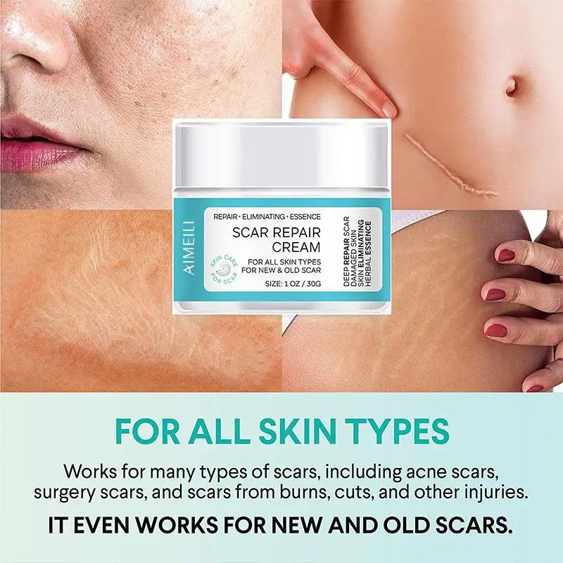 

Увлажняющий отбеливающий крем для восстановления шрамов после ожогов