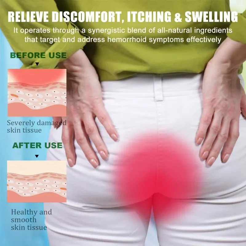 Травяные капсулы от геморроя восстановление ануса облегчение отеков