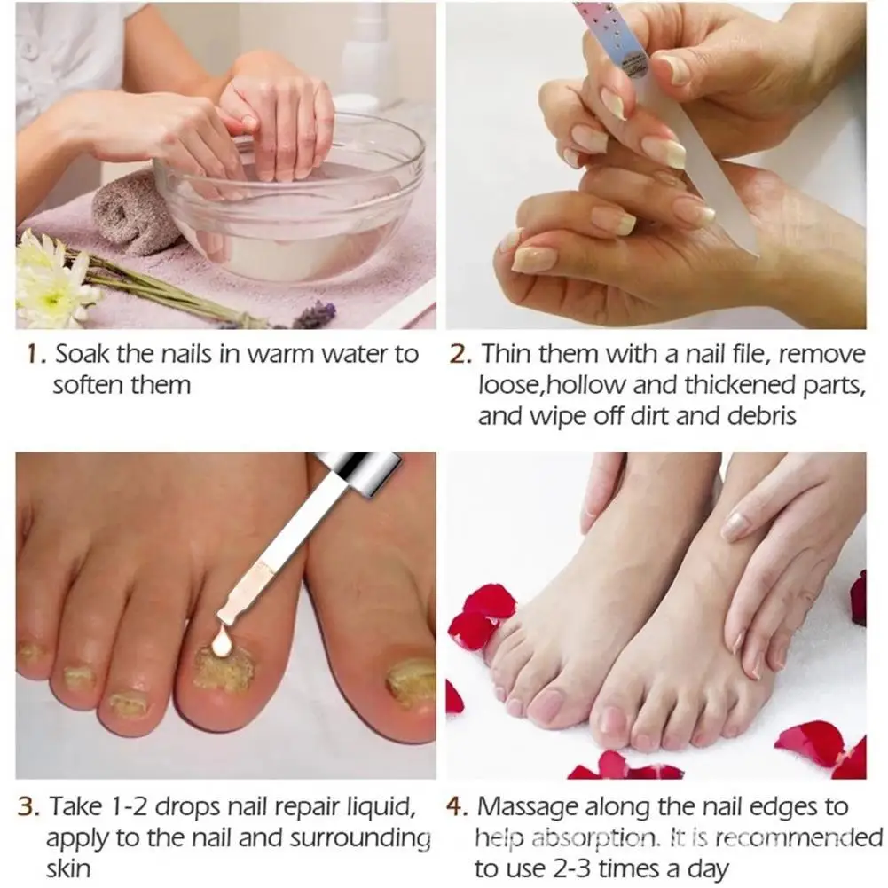 

Gentle Wide Application Fungus Removing Manicure Repair Essence for Home