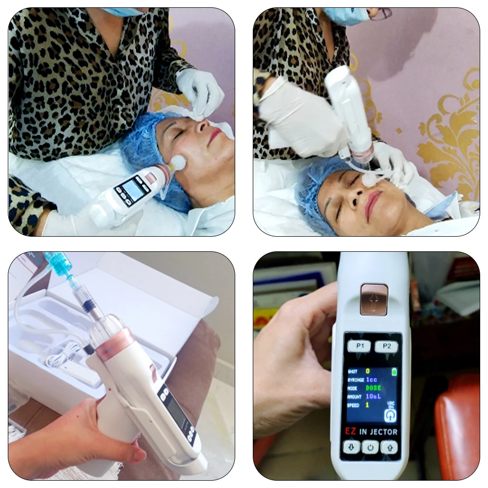 Рисунок 2 - 5/9 игла фильтр отрицательного