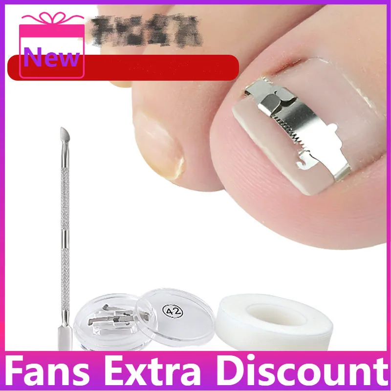

Hot Sale Stainless Ingrown Foot Care Tool Toe Nail Fixer Pedicure Recover Embed Toenail Correction Lifter Tool Kit Inset Buckle