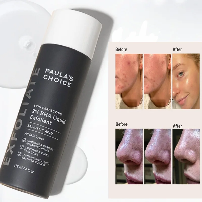 

Paulas Choice-SKIN PERFECTING 2% BHA Liquid Salicylic Acid Exfoliant-Facial Exfoliant Blackheads Acne/Spot Removing Face Serum