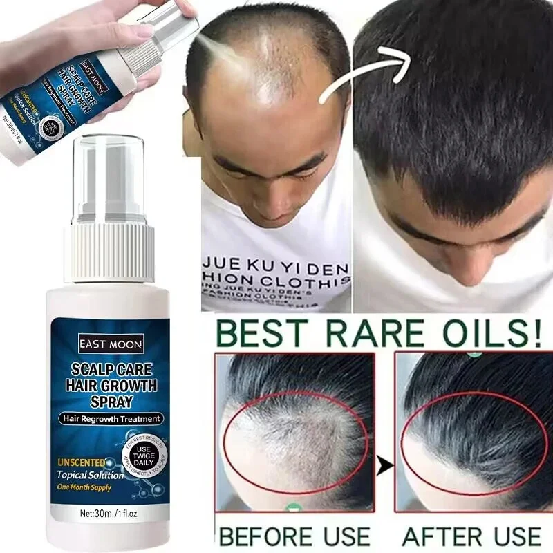 Powerful Hair Growth Serum Spray Prevent Hair Loss Essential Oil Fast Growing Repair Nourish Scalp Treatment For Men Women 30ml