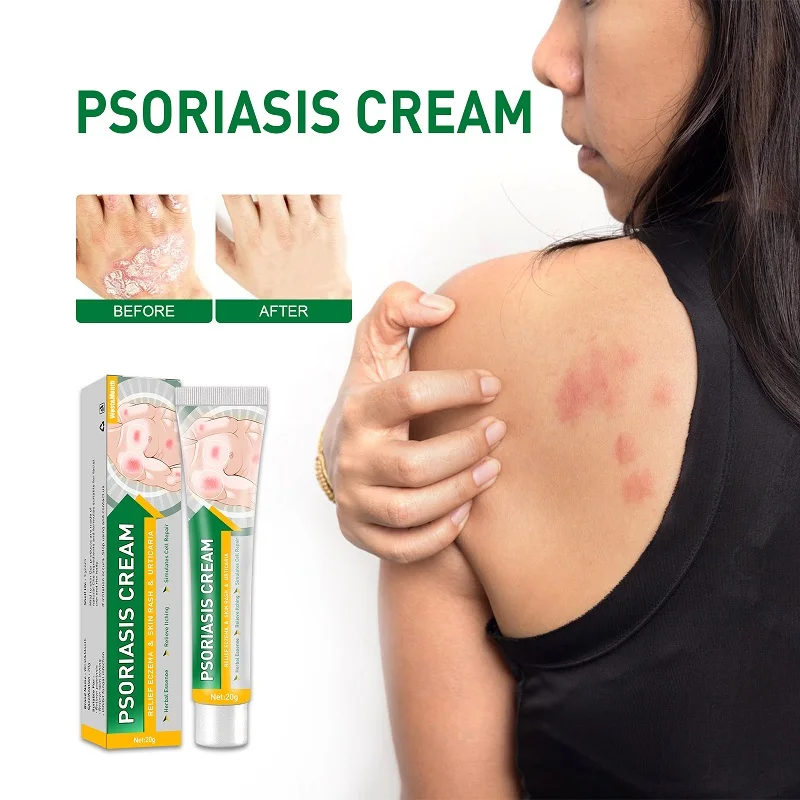 

Plant Ointment Cream Psoriasis Antibacterial Treatment Anti-itchy Eczema Cream Skin Rash Urticaria Desquamation Body Skin Care