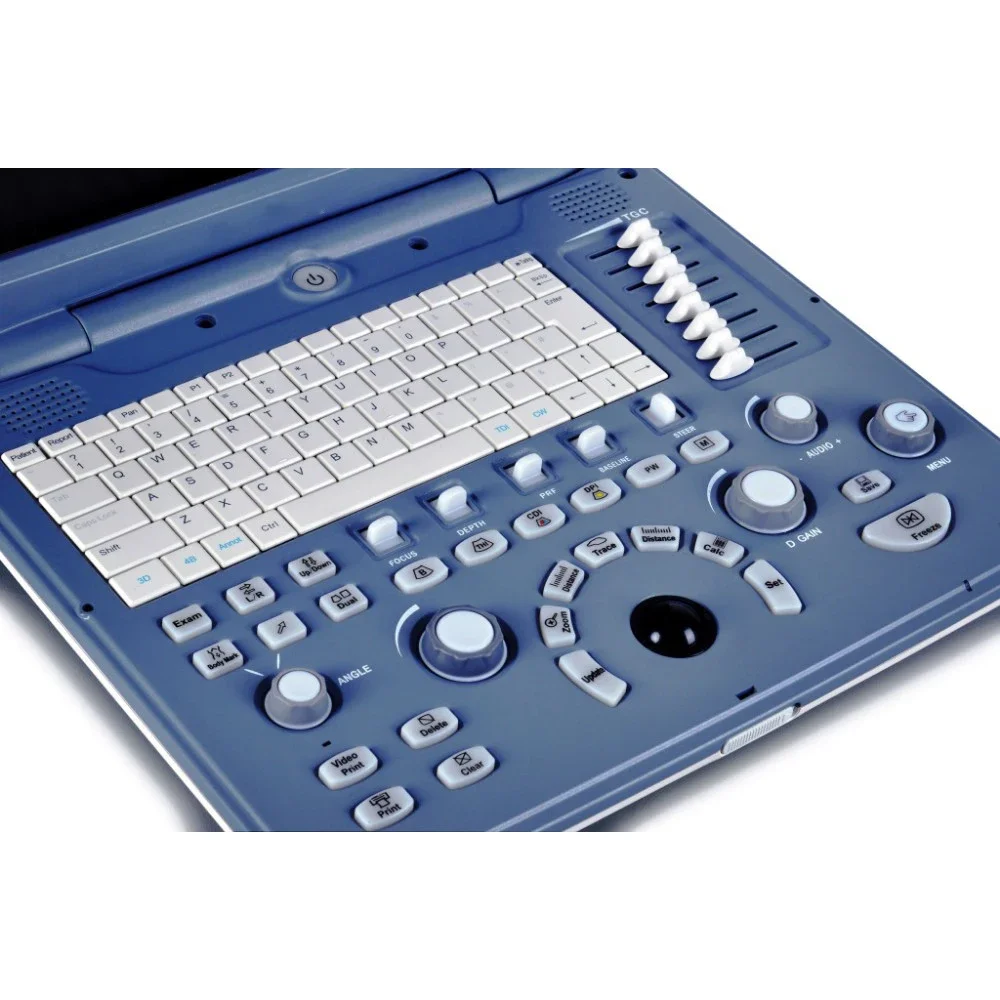 Портативный ультразвуковой аппарат Color Doppler Sonoscape S2 портативный