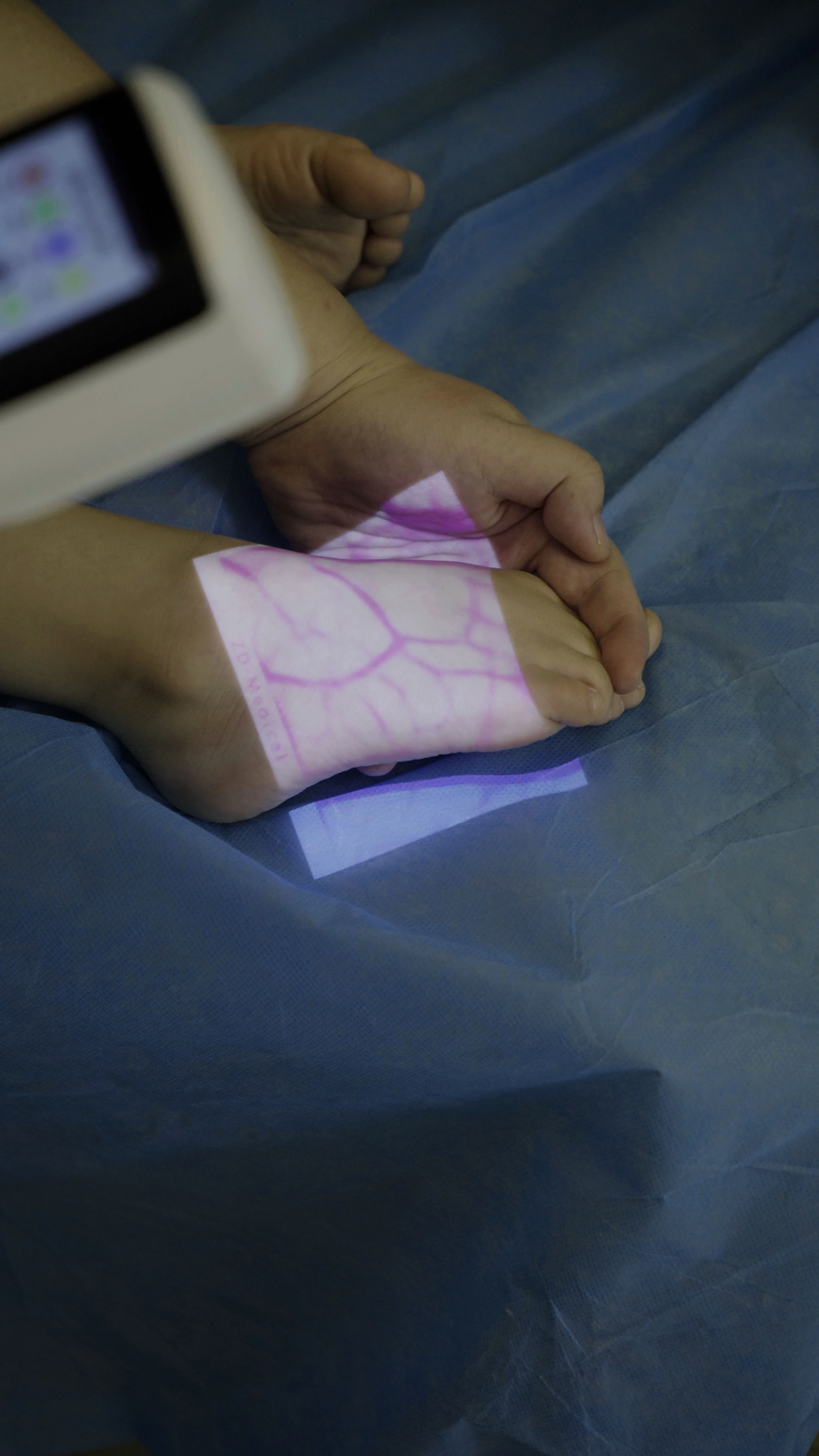 Медицинский проекционный ручной прибор для обнаружения венозных сосудистых