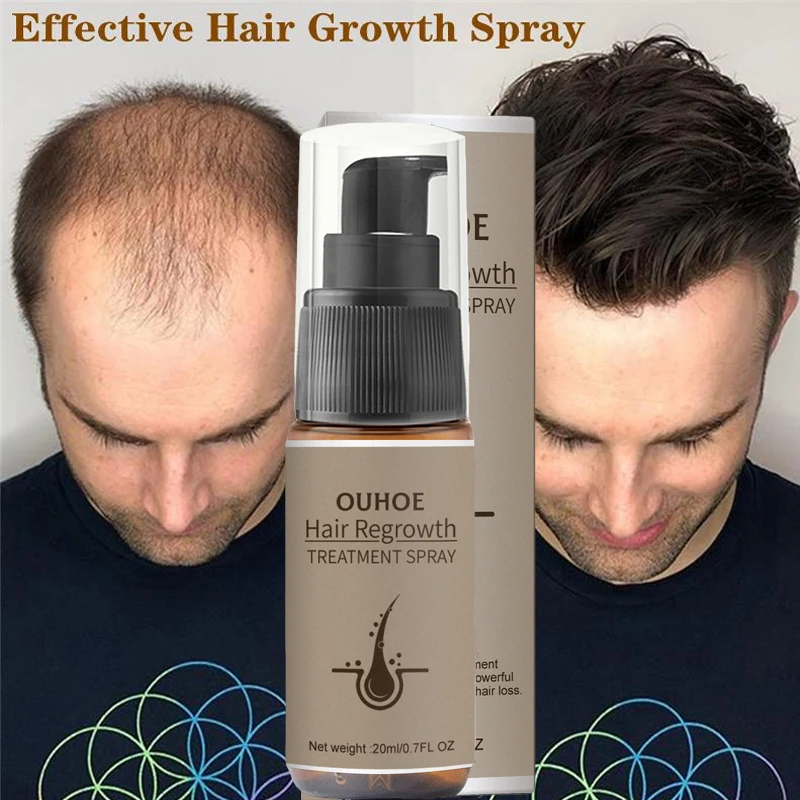 

Мощный рост волос, искусственный имбирь, средство для лечения выпадения волос, восстанавливает питание корней волос, искусственные волосы для мужчин и женщин