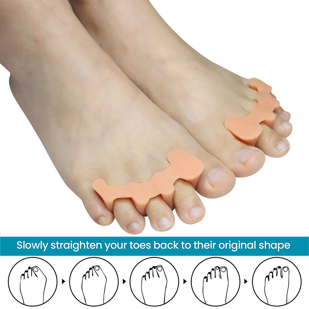 Рисунок 6 - разделители для пальцев ног для