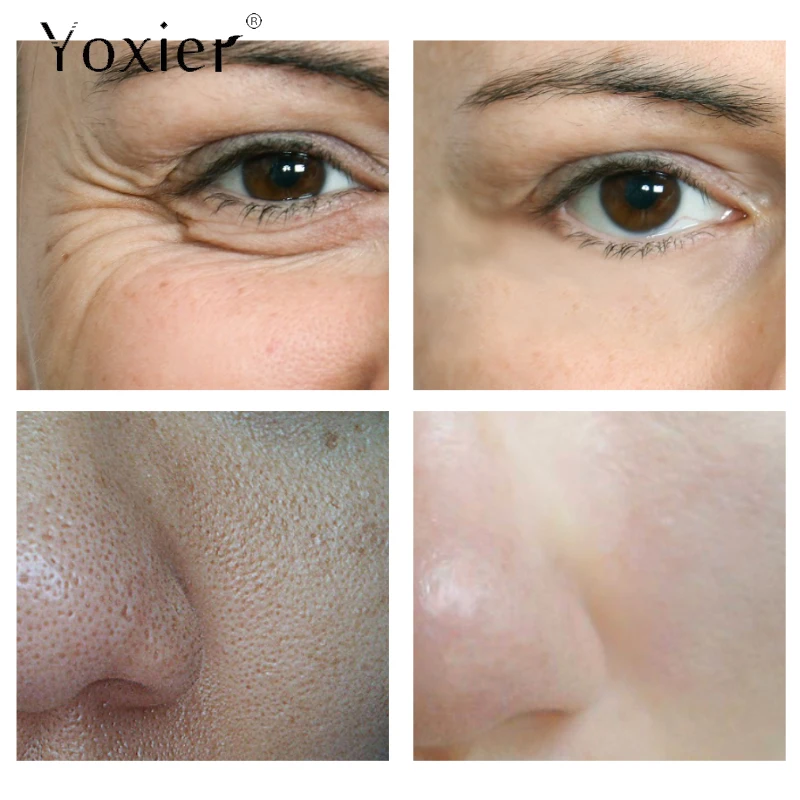 Сыворотка против морщин увлажняющая отбеливающая укрепляющая лифтинг старения