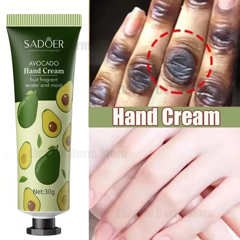 Отбеливающий крем для рук с авокадо и темными костяшками | AliExpress