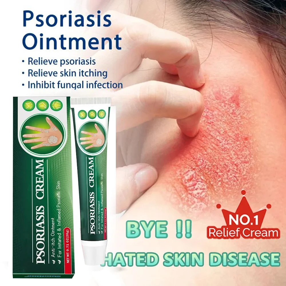Противозудный крем от экземы и псориаза антибактериальный для тела с дерматитом