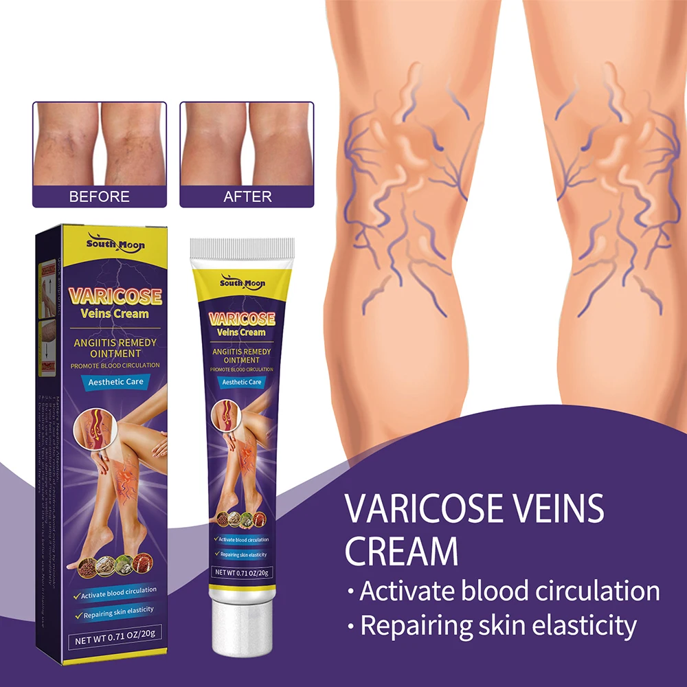 

Vein Relief Cream Varicose Vein Relief Pain Relief Cream Repair Earthworm Legs Relieve Swollen Painful Bulging Leg Veins 2023