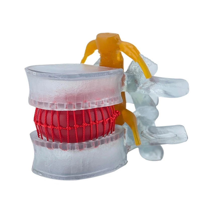 

Анатомия, модель поясничного отдела позвоночника, демонстрирует 4-й Поясничный вертебер 5-й Поясничный вертебер K1KF