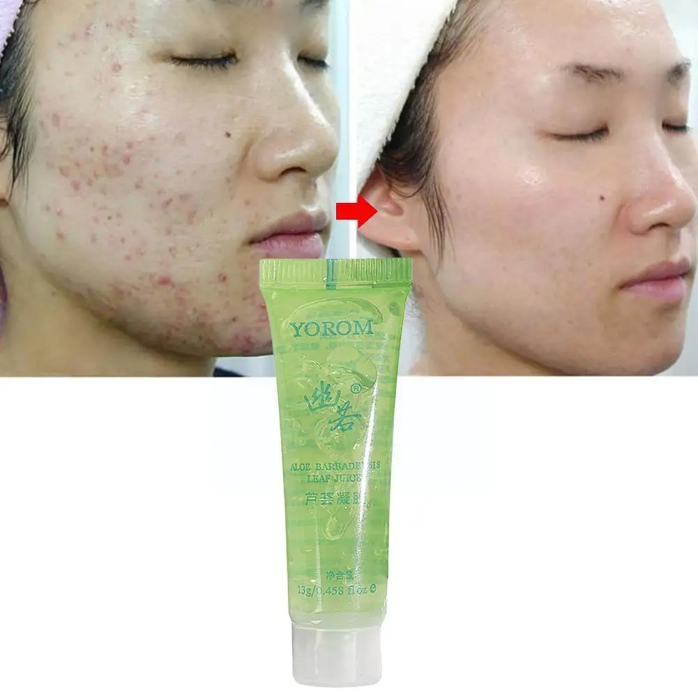 

Aloe Vera Acne Scar Removal Cream Acne Spots Burn Gel Skin Whitening Treatment Removal Surgical Moisturizing Gel Care Scar G1U9