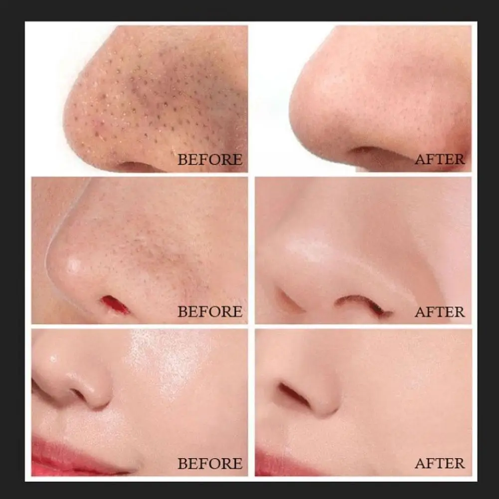 Рисунок 5 - Маска для удаления черных точек